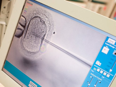 MONITORIZACIÓN TIME LAPSE